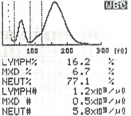 zeidiskrees Signal: man kenn den Signalwer nich in allen Zeipunken Sinusunkion höchser Frequenz die zur Fourierschen Hersellung nöig is abas max, rekonsruieres Signal: konsan abas,5 max, die Frequenz
