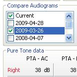 Die manuelle Aufzeichnung von Audiogrammen auf Papier wird durch eine elektronische Aufzeichnung in einer grafischen Echtzeitschnittstelle ersetzt.