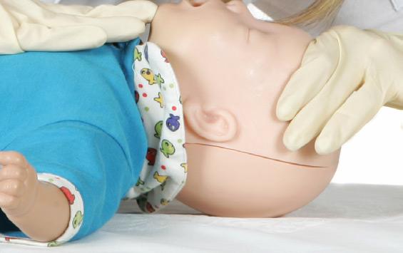 Hat der Patient eine normale Atmung ist er bewusstlos und wird in die stabile Seitenlage (beim Säugling Bauch- Seitenlage) gebracht.