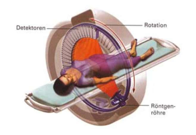CT Aufbau Detektoren Rotation Röntgenröhre