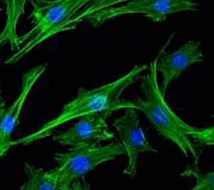 UNTERSUCHUNG DER BIOAKTIVITÄT DES IPH AEN-PEPTID-KOMPLEXES IN KULTUREN DER CHONDROZYTEN DER RATTEN Ziele und Aufgaben Materiale und Methode Das Ziel der Untersuchung Das Ziel der Forschung bestand an