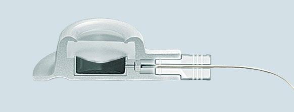 Die Portkathetersysteme der pfm medical ag sind vollständig implantierbar und ermöglichen einen wiederholbaren, kontinuierlichen venösen Zugang.