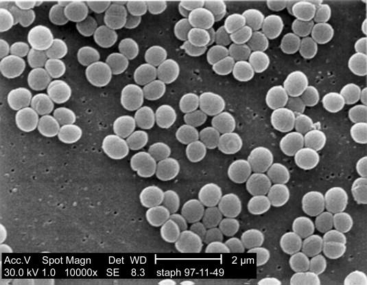 Staphylococcus aureus Staphylococcus aureus fakultativ anaerobe, grampositive Kokken wichtiger Mastitiserreger
