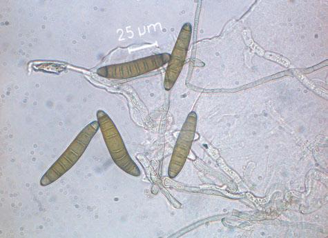 Braun- oder Schwarzfleckigkeit Bipolaris zeicola, synonym Helminthosporium