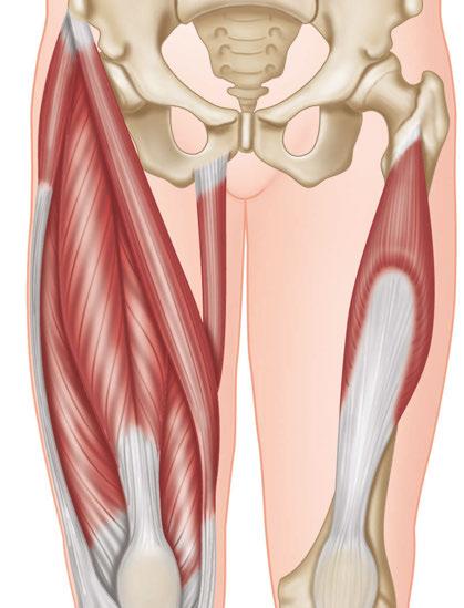 Sportverletzungen am Knie Die klinisch wichtigen Bursen sind vorne die suprapatellaren und infrapatellaren Schleimbeutel, hinten der Kniekehlen-Schleimbeutel sowie die Bursa anserina.