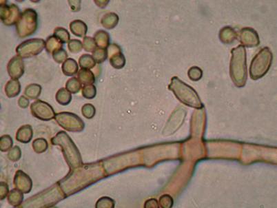 Keim Bei einem Keim handelt es sich um eine keimfähige Spore, ein wachstums fähiges Hyphenstück oder eine vermehrungsfähige Zelle.