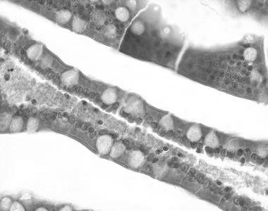 In den Einbuchtungen (Krypten) der Villi liegen die Paneth-Körnerzellen, die antimikrobielle Peptidasen und Lysozyme, sog. Defensine, ans Darmlumen abgeben.
