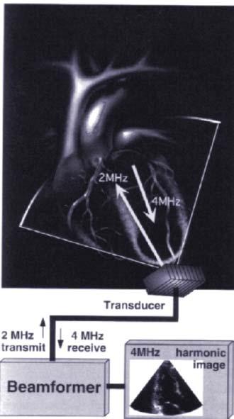 Abb. 3: Prinzip des Harmonic Imaging: Während der ein konventioneller Ultraschallimpuls verwendet wird, der Receiver so modifiziert, dass nur die doppelte Frequenz des Ausgangsimpulses detektiert