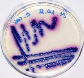 Nachweis von coliformen Bakterien / E.