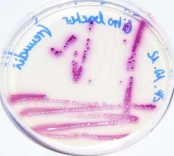 Coliformen- Agar (CCA) auflegen (36 ± 2) C, (21 ± 3) h rosa bis rote Kolonien dunkelblaue bis violette