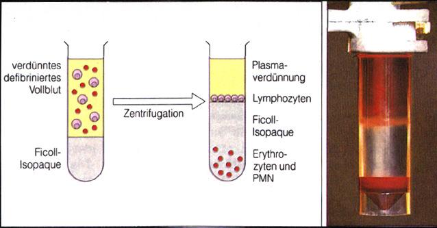 Figuren 93 Figur 5: Schematische Darstellung von Isolierung (a) und Sortierung (b) der CD19+ B-Zellen aus dem peripheren Blut von SLE-Patienten (a) Abtrennung der B-Zellen mittels Ficoll-Hypaque