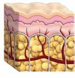 LASERLIPOLYSE WIE WIRKT LASERLIPOLYSE? Diese minimalinvasive Methode wirkt in den oberen Hautschichten und lässt den äußeren Schutzmantel der Haut unversehrt.