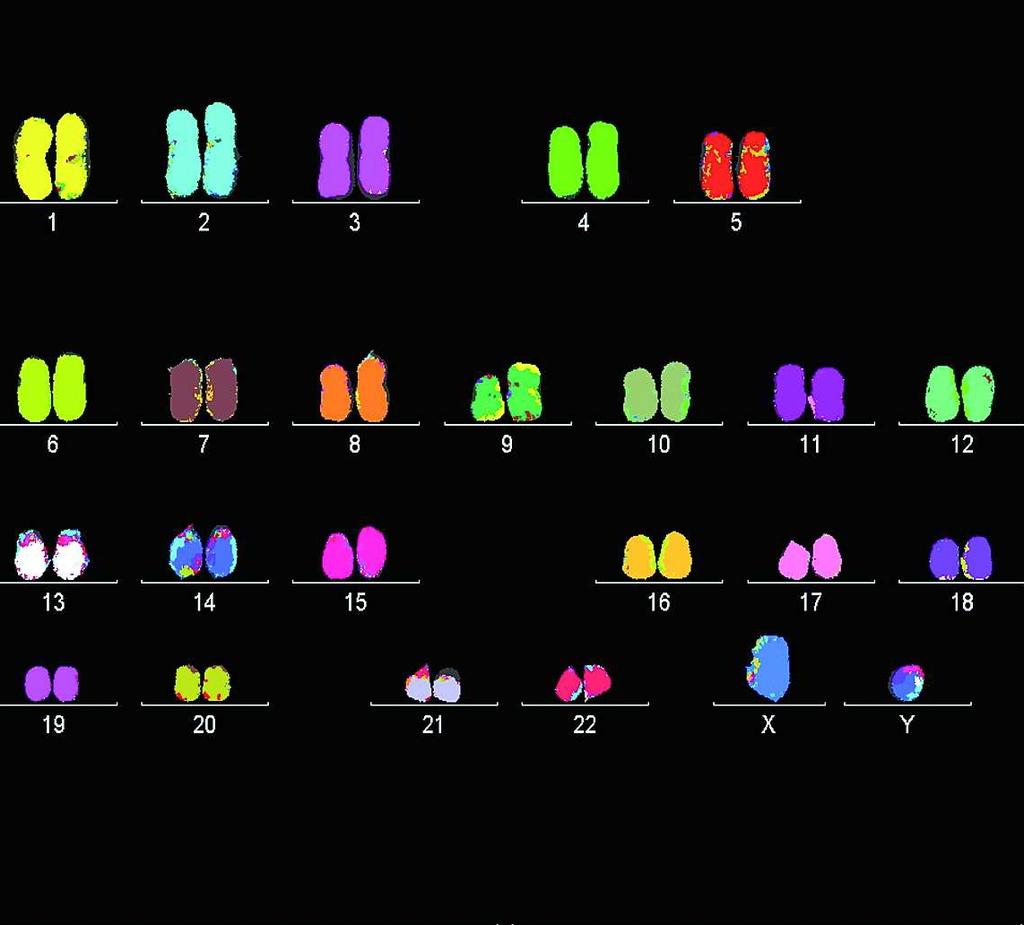 Abbildung 4 Chromosomensatz einer normalen Zelle mit 23 Paaren regelrechter
