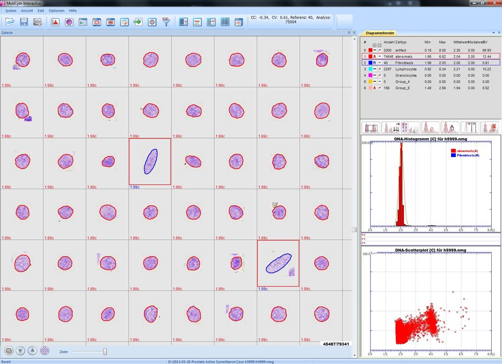 Abbildung 8 Monitor der DNA-Bildzytometrie.