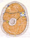 4. Oberflächliche Rückwärtige Armlinie Die myofasziale Verbindung vom Occiput zur Dorsalseite