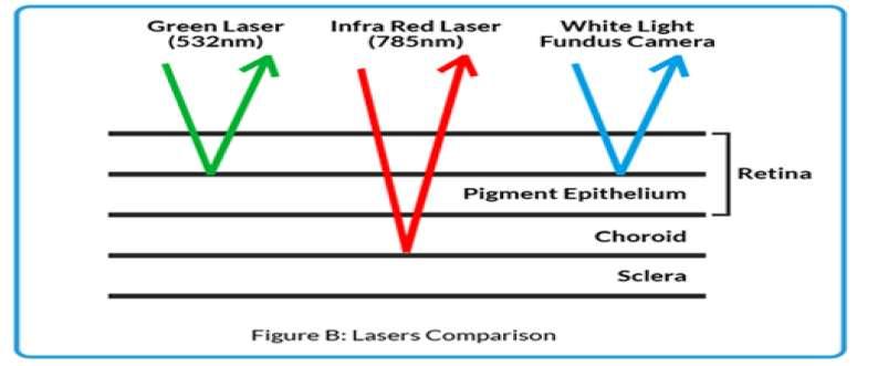 Grundlagen SLO Scanning Laser Opthalmoscopy SLO