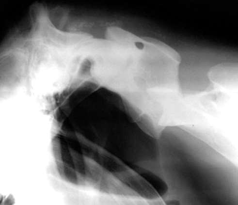 Fallbeispiel 5 bildgebende Diagnostik Digitale Röntgenbilder