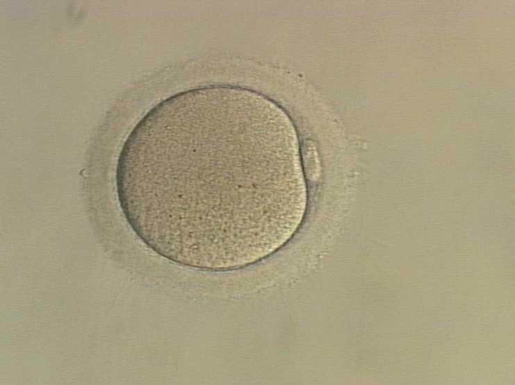 Ziel der ovariellen Stimulationsbehandlung Heranreifen vieler Eizellen Verhinderung einer vorzeitigen