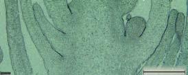 (B) The dissected plant in (A), showing the structure present at each node. Bar, 4 cm. (C) The micro-dissected apex of a representative 8 week old Arabis alpina Pajares plant as in (A).