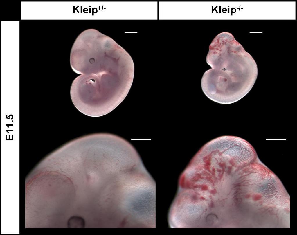 Results A B Figure 14: Kleip-deficiency causes growth retardation and hemorrhages. In (A) one E11.