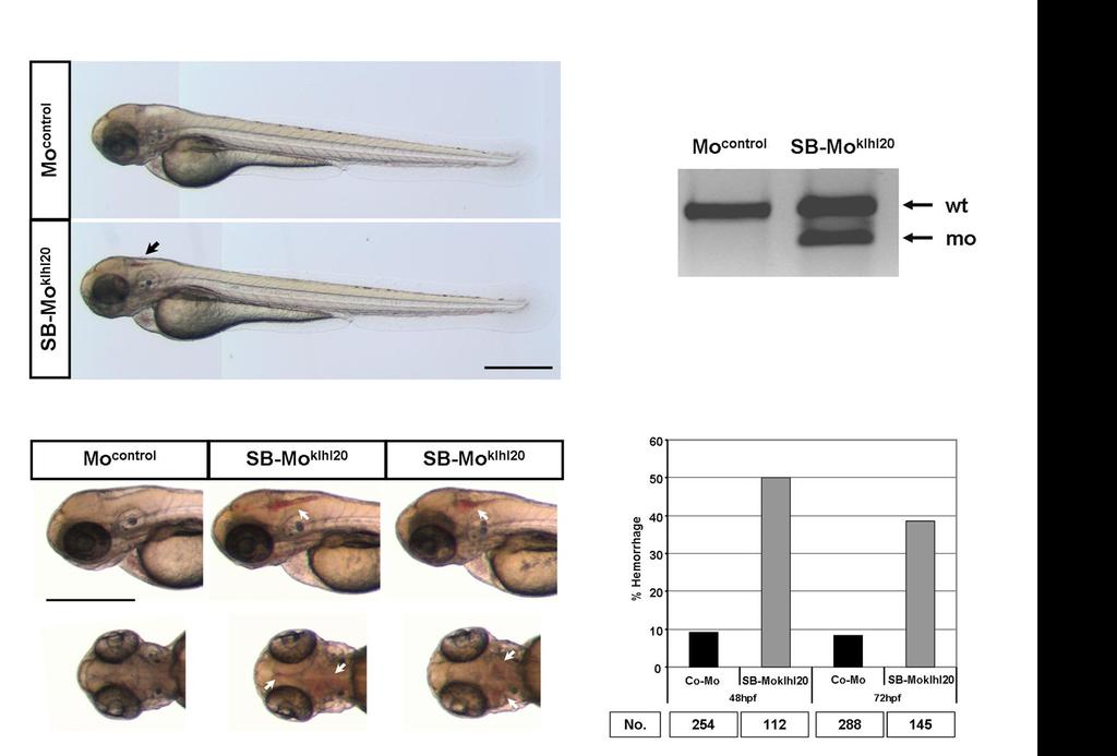 Results A C B D Figure 21: Klhl20 is essential to maintain vascular integrity in vivo. Morpholino-based silencing of klhl20 does not affect zebrafish morphology (A).