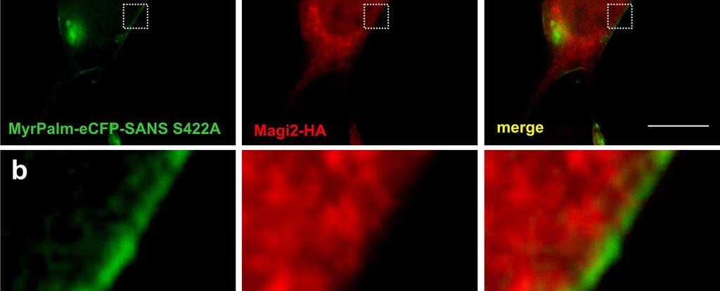 (a) High magnification revealed recruitment of Magi2 to the plasma membrane (yellow).