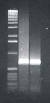 RT-PCR Reverse Transcription Polymerase Chain Reaction Blut mrna DG + DNAse RT PCR Ergebnis Zellen DNA bp bp bp bp 1000 500 300 200 50 ck20 371 bp ck19 214 bp 1000 500 300 200 PSA 486 bp 4072 3054