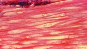 Glatte Eingeweidemuskulatur Die Zellen der glatten Eingeweidemuskulatur sind rauten- bzw. spindelförmig und nur ca.
