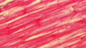 Quergestreifte Herzmuskulatur Die Zellen der Herzmuskulatur ähneln unter dem Mikroskop mit ihrer Querstreifung denen der quergestreiften Skelettmuskulatur,