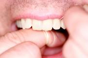 Bakterielle Beläge (Plaque und Zungenbelag) werden mit Zahnbürste und Zungenreiniger mechanisch entfernt.