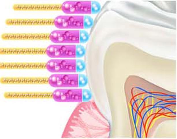 05 / Zahnprophylaxe Fluoride Arbeitsblätter 2/8 Die schützenden Fluoride Fluorid bietet in der richtigen Dosierung Schutz vor Karies und lagert sich in den Zahnschmelz ein.