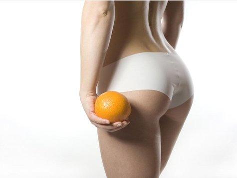 Cellulitebehandlung im Hautverjüngungsprogramm Das Problem Über 80 % aller Frauen über 20 Jahren sind von Cellulite (Orangenhaut) betroffen! Auslöser dieses Gewebezustandes sind verschiedene Faktoren.