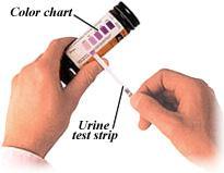 cetoacetate OH O CH 3 -CH-CH 2