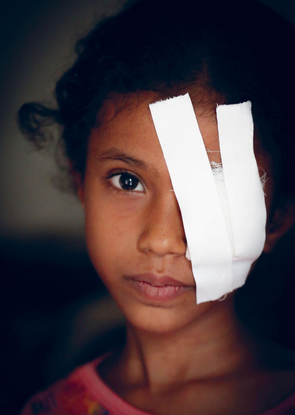 VORWORT Jemen: Die achtjährige Razan* wurde bei einem Luftangriff in Hodeida durch Granatsplitter schwer am Auge verletzt.