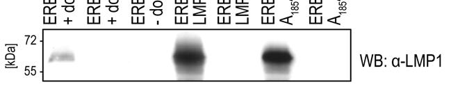 4 ERGEBNISSE 98 Abbildung 41: In den EREB-pRTS1-Zelllinien lässt sich endogenes und exogenes LMP1 durch Östrogen bzw. Doxycyclin regulieren.