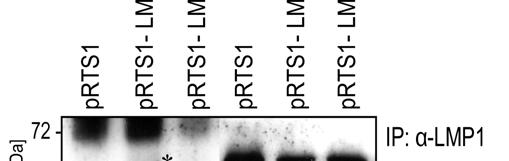4 ERGEBNISSE 99 Abbildung 42: In IPs aus humanen B-Zellen präzipitiert nur LMP1 wt, nicht aber LMP1 A185A SHP-1.
