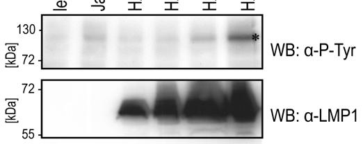 4 ERGEBNISSE 106 Abbildung 50: Die LMP1 vermittelte Jak3-Phosphorylierung durch LMP1 wird in DG75 Zellen von SHP-1 inhibiert. In 1x 10 7 DG75 Zellen wurden Lachsspermien-DNA bzw.