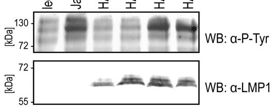 4 ERGEBNISSE 107 Abbildung 51: Dominant negatives SHP-1 revertiert die Unterschiede in der Jak3-Phosphorylierung zwischen LMP1 wt und LMP1 A185A. In 1x 10 7 DG75-Zellen wurden Lachsspermien-DNA bzw.