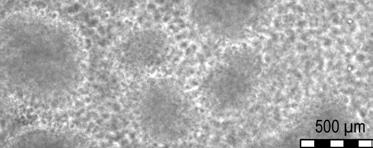 Um ein Auswachsen der LCLs zu verbessern, wurden die infizierten Zellen auf humanen embryonalen Fibroblasten (WI38) kultiviert, die zuvor mit einer subletalen Dosis an letal γ Strahlen bestrahlt