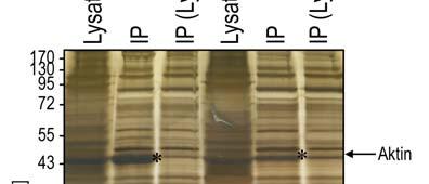 4 ERGEBNISSE 62 In der Silberfärbung des SDS-Gels, auf dem die IPs aufgetrennt worden waren, wurde deutlich, dass sich auch in der Kontroll-IP eine Vielzahl verschiedener Proteine befinden.