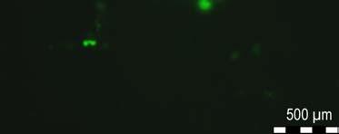 Abbildung 22 zeigt die so ausgewachsenen grünen TEV-LCLs des Klones 5 (TEV-LCL5), der aus der DNA von p2089-ha-lmp1-2xli-tev-ct Klon