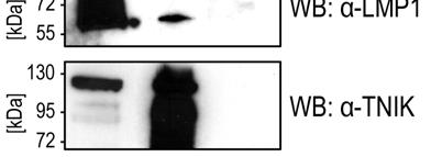 4 ERGEBNISSE 87 Abbildung 31: TNIK und LMP1 interagieren in LCLs. Um LMP1 mit TNIK zu präzipitieren, wurden 1x 10 8 721 Zellen in IP-Lysepuffer lysiert.