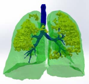 com CT-Scanner für hochaufgelöste Computertomographie methodische Details: angehaltener Atem ein-