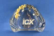 ICX-Plexiglas-Schaumodelle Artikel-Nr. Artikel Preis * BS-PM0001 Plexiglas Modell ohne ICX Modellanaloge 90, ICX-SCHAUMODELLE Artikel-Nr.
