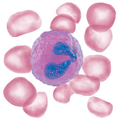 Rote Blutkörperchen Eosinophile Entzündungszelle Gelappter Kern Bläschen Abb. 5: Eosinophile Entzündungszelle aus dem Blut. Die eosinophile Entzündungszelle ist umgeben von roten Blutkörperchen.