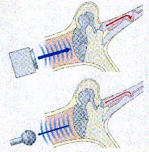 Einleitung 12 Die otoakustischen Emissionen entstehen sozusagen als Abfallprodukt der aktiven Kontraktionen der äußeren Haarzellen, indem sich eine sekundäre Wanderwelle Richtung äußeren Gehörgang