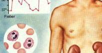 Tubuläre Störungen dominieren Medikamentenanamnese Fieber