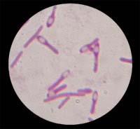 Kreislaufschwäche, Untertemperatur Bacillus cereus