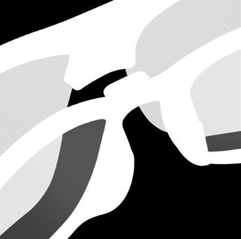 So kann die Brille ohne Kor rektion verwendet oder mit Kontaktlinsen kombiniert werden. Mit einem Handgriff kann der Korrektionseinsatz montiert und auch demontiert werden.