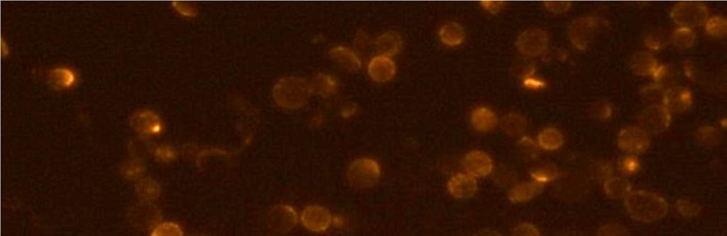 3.2 Aufarbeitung der Gewebeproben 3.2.1 Indirekte Immunfluoreszenzfärbung zum Nachweis des Oberflächenantigens MCSP auf disseminierten Tumorzellen Nach der Lymphknotenentnahme wurde die Gewebeprobe aufgeteilt.